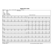 Rapport ECG Edan