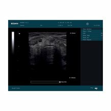 Echographe portable Edan DUS60